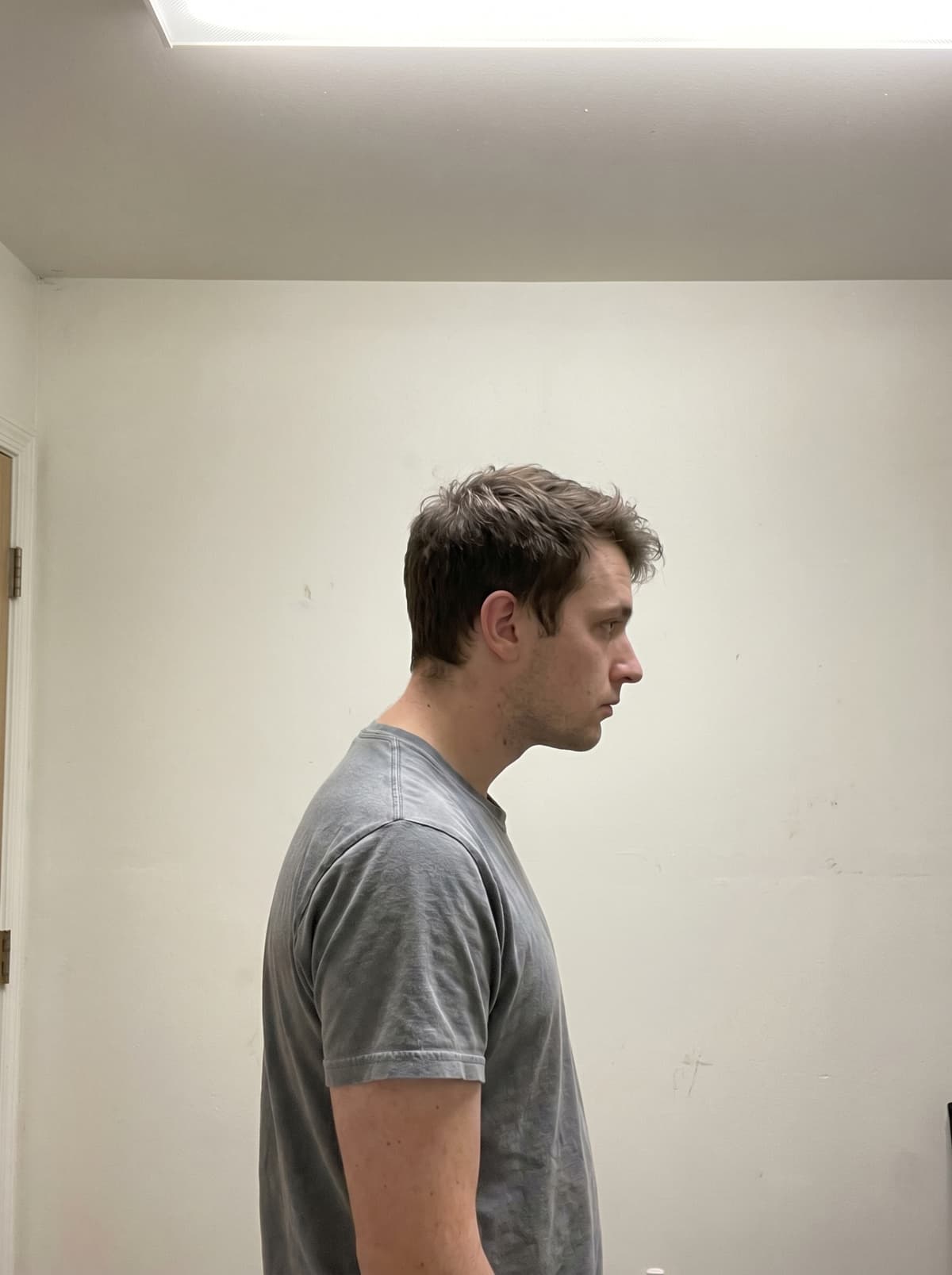 Before: forward head posture